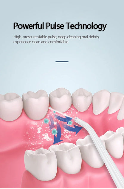 Dental Water Flosser (30% off)